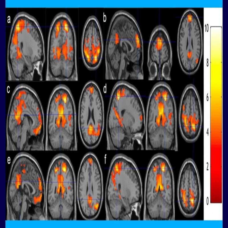 Five-Minute Meditation: Cultivating Calm and Stress Reduction - Image 1