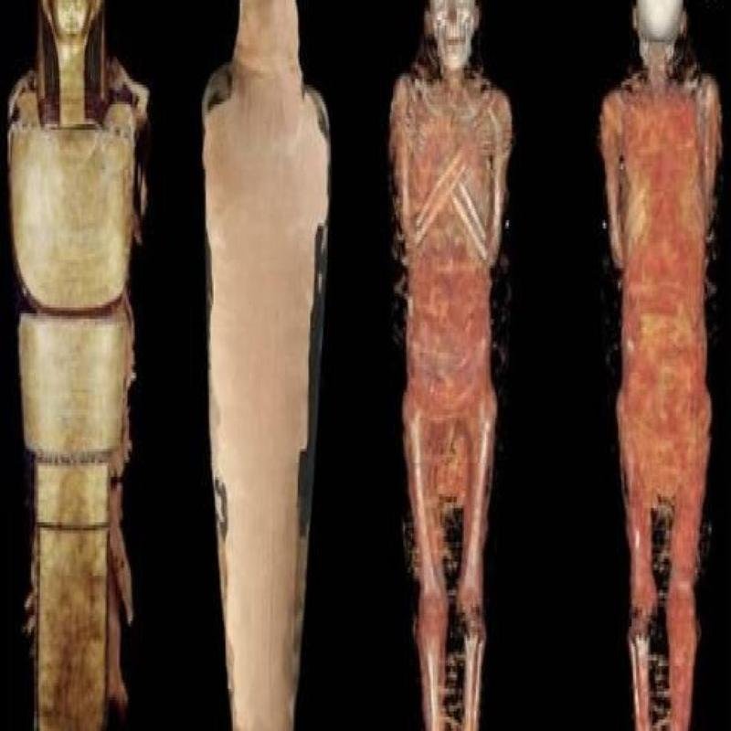 A Newly Discovered Mummy: A Remarkable Find - Image 3