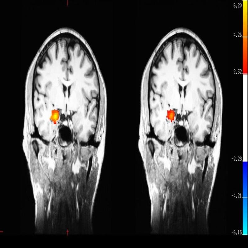 Five-Minute Meditation: Cultivating Calm and Stress Reduction - Image 2