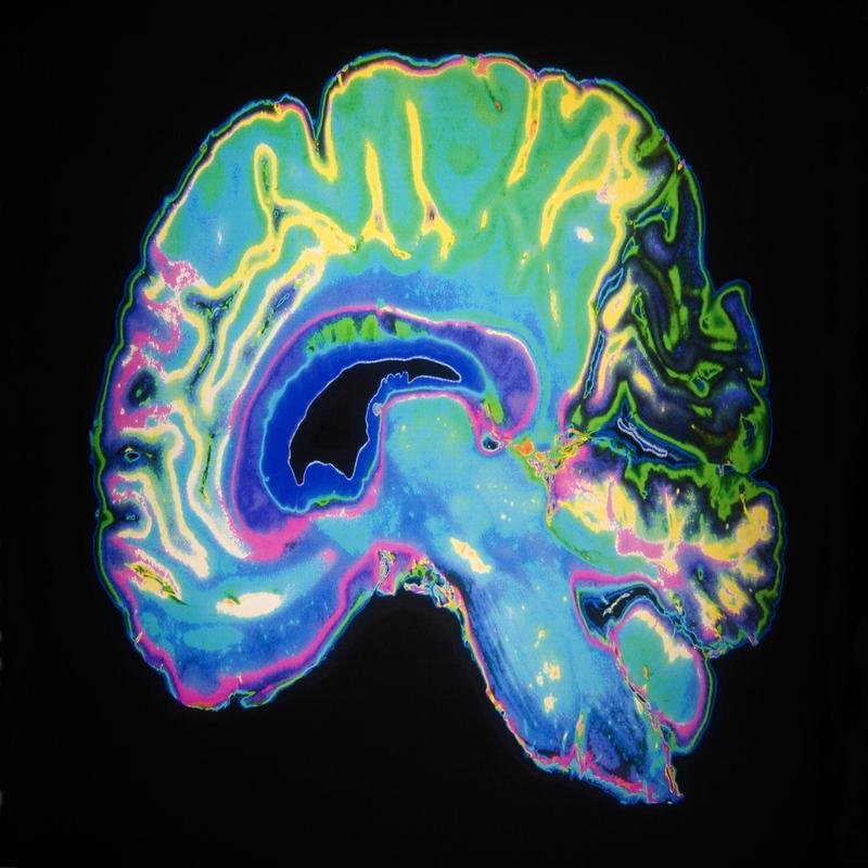 Significant Advancement: Deciphering the Language of Dreams. - Image 3