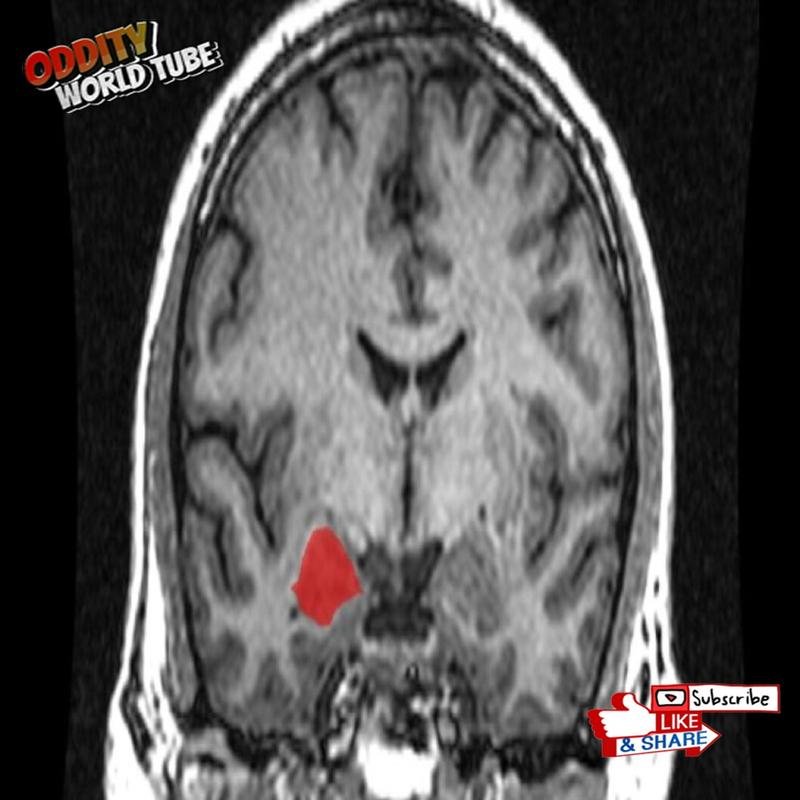 Rapid Decision-Making: A Neuroscientific Examination of Intuitive Judgment - Image 2